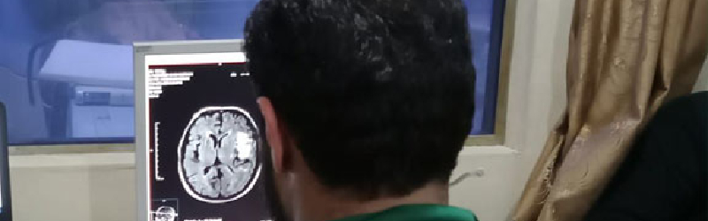 الكشف المبكر عن ورم سحائي ينقذ حياة مريض